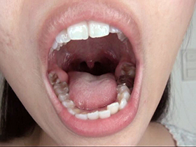 300人のおくち　3　サンプル画像14